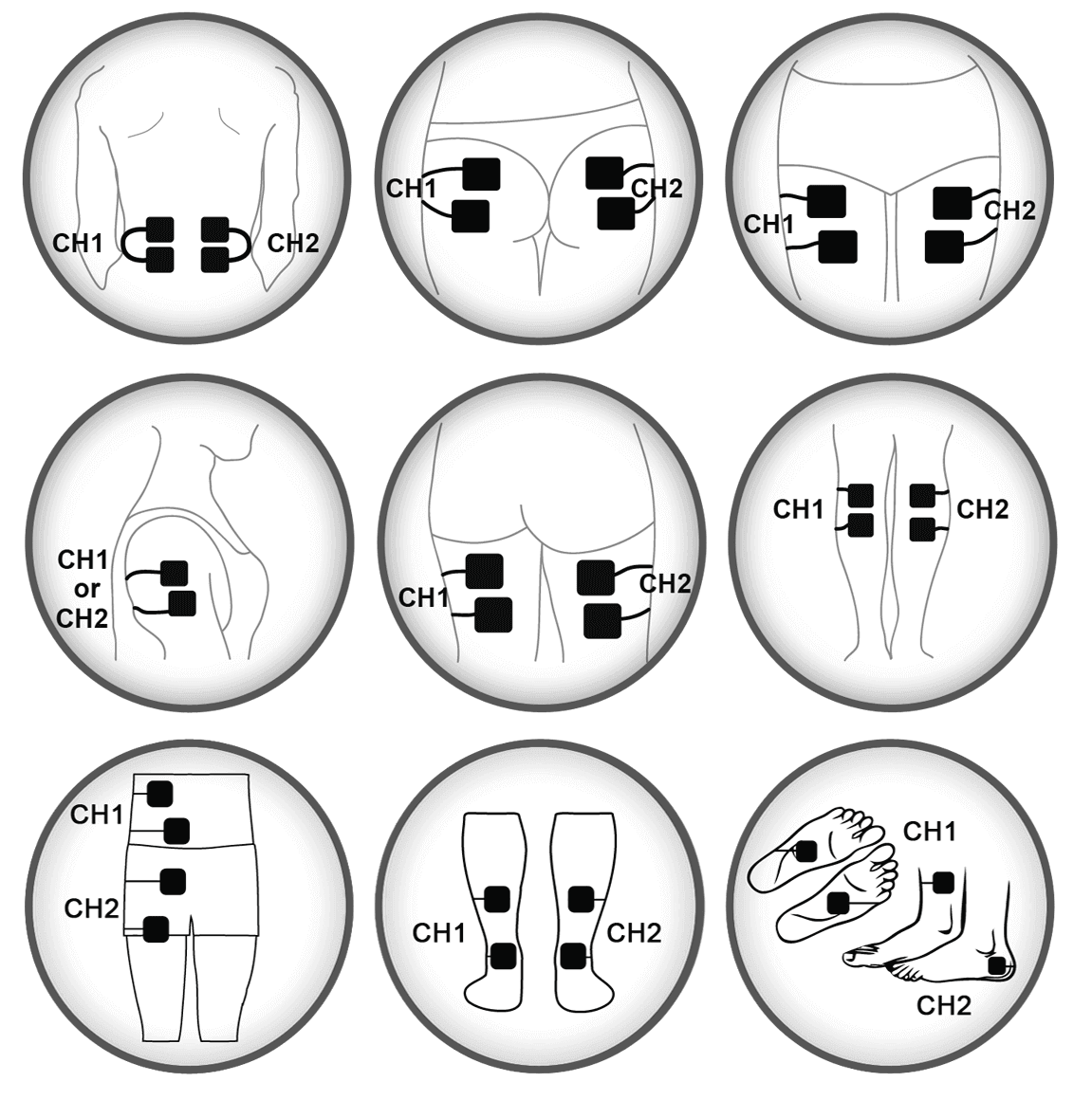 iReliev Small Electrode Pad Placement