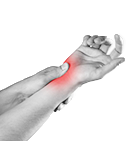 Arthritis Wrist and Arm Pain