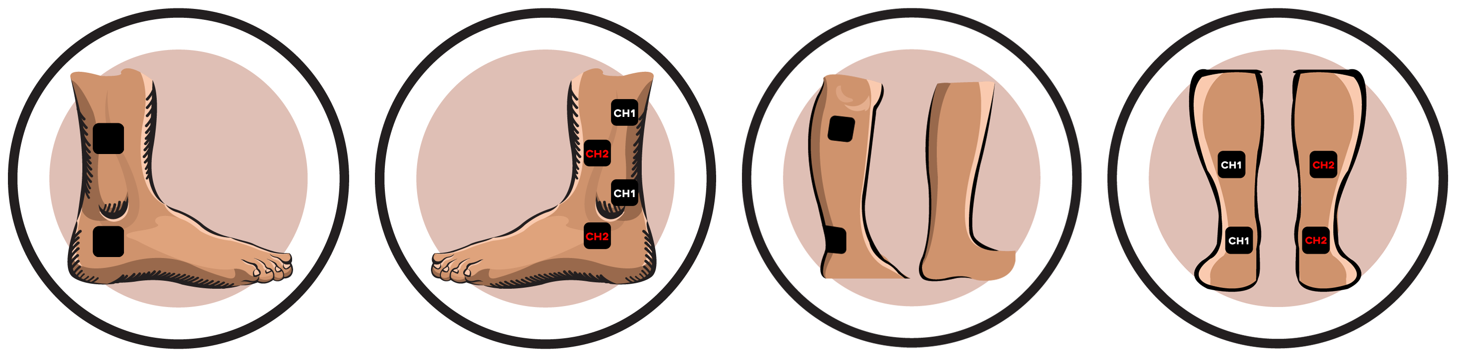 Ankle Electrode Pad Placement