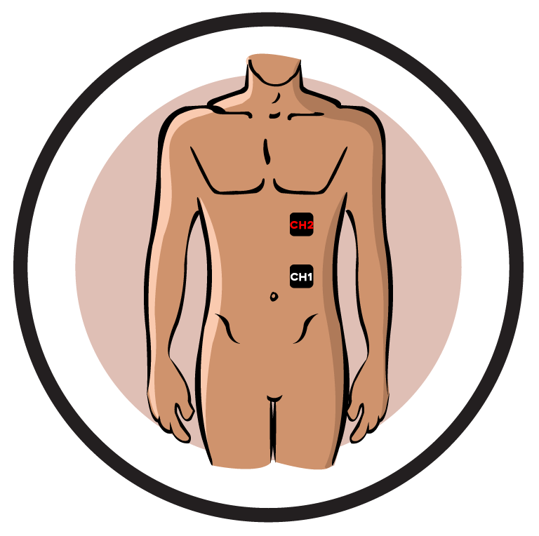 Herpes Zoster Neuralgia Electrode Pad Placement