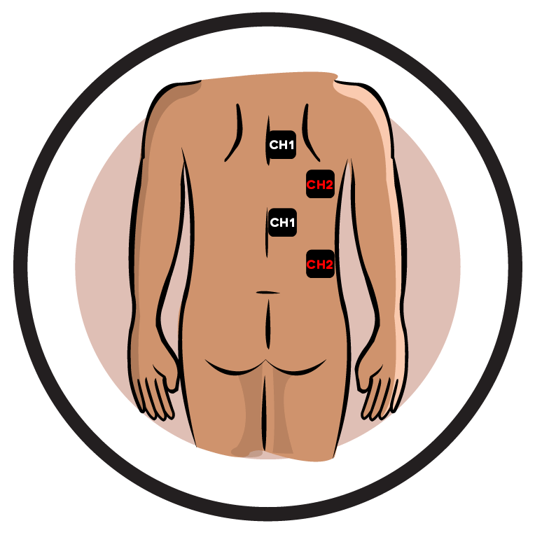 Mastectomy Electrode Pad Placement