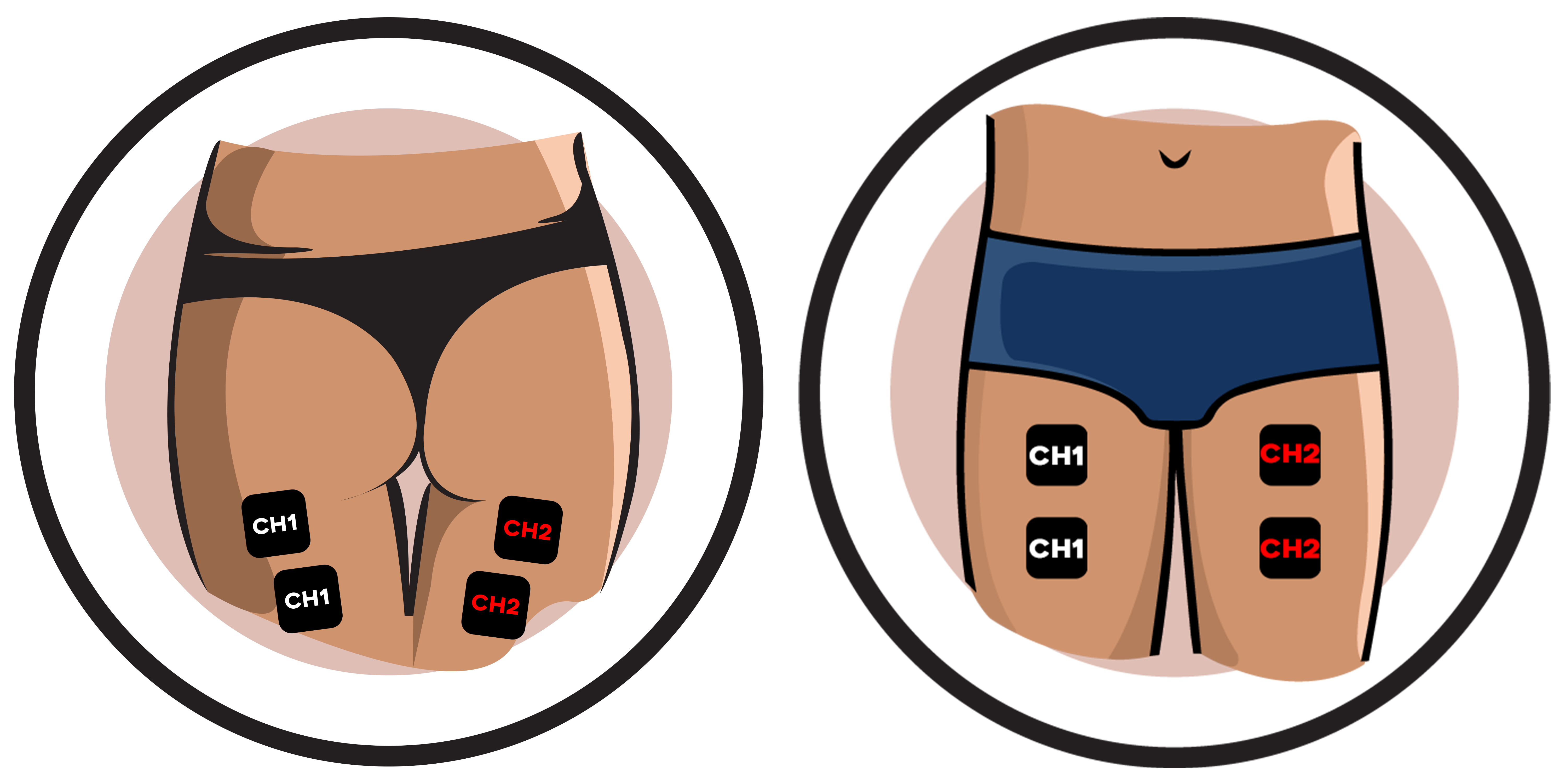 Thigh Electrode Pad Placement