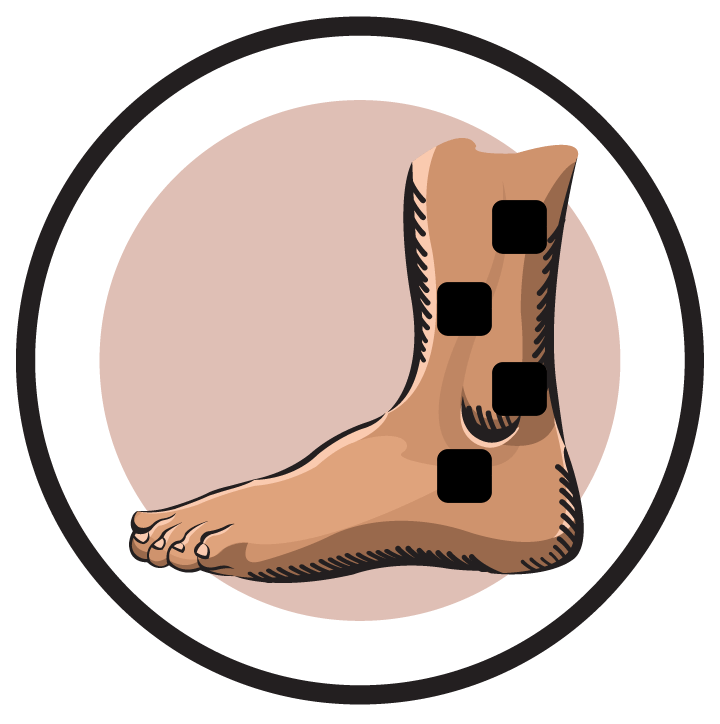 Ankle Electrode Pad Placement