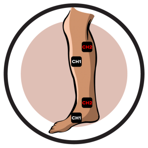 Low Extremity Pain-Reflex Sympathetic Dystrophy Electrode Pad Placement